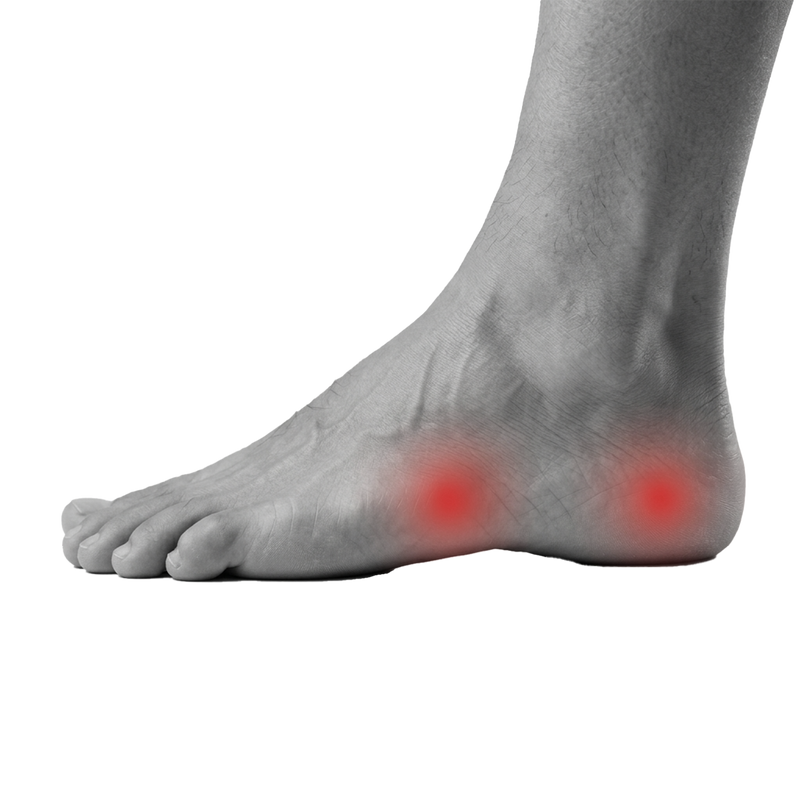 Diabetic Foot Care